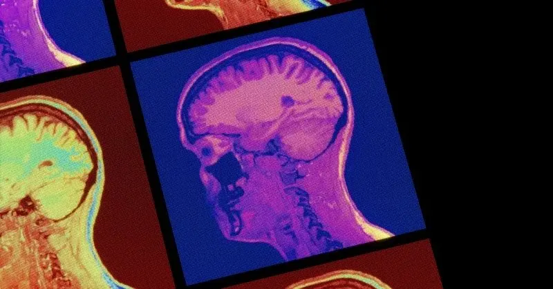 Brain-Tracking Wearables Are the Next Biohacking Trend — But Should You Strap One On?